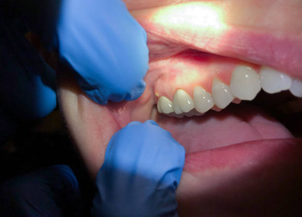 Best Emergency Dentist Near Me  in Brook Park, OH