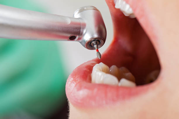 Best Tooth Infection Emergency Dentist  in Brook Park, OH